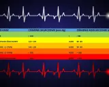 Tabela ciśnienia krwi: 120/90 to stan przednadciśnieniowy. Wykres EKG pokazuje rytm serca.