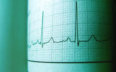 EKG z tętnem 94. Czy to norma? Wykres pokazuje rytm serca, a wynik 94 uderzeń na minutę jest w granicach normy dla dorosłych.